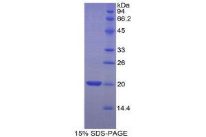 SDS-PAGE (SDS) image for Myosin, Light Chain 2, Regulatory, Cardiac, Slow (MYL2) (AA 2-159) protein (His tag) (ABIN1879217)