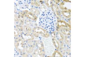 Immunohistochemistry of paraffin-embedded rat kidney using MYLK antibody. (MYLK 抗体  (AA 1765-1914))