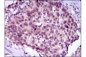 Flow cytometric analysis of HeLa cells using MEF2C antibody (green) and negative control (purple). (MEF2C 抗体  (AA 1-125))