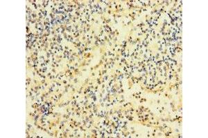 Immunohistochemistry of paraffin-embedded human spleen tissue using ABIN7167200 at dilution of 1:100 (RAC2 抗体  (AA 1-189))