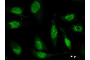 Immunofluorescence of monoclonal antibody to ZNF181 on HeLa cell. (ZNF181 抗体  (AA 354-461))