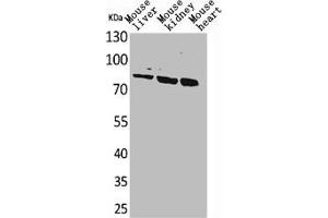 Western Blot analysis of mouse liver mouse kidney mouse heart cells using CUL-4B Polyclonal Antibody (Cullin 4B 抗体  (Internal Region))