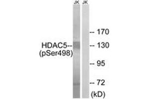 Western blot analysis of extracts from Jurkat cells, using HDAC5 (Phospho-Ser498) Antibody.