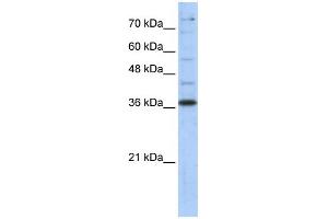 WB Suggested Anti-GAPDH Antibody Titration:  0. (GAPDH 抗体  (Middle Region))