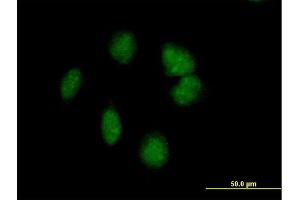 Immunofluorescence of purified MaxPab antibody to POMC on HeLa cell. (POMC 抗体  (AA 1-267))