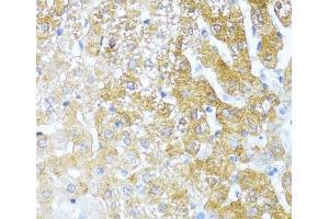 Immunohistochemistry of paraffin-embedded Rat liver using SERPINA3 Polyclonal Antibody at dilution of 1:100 (40x lens). (SERPINA3 抗体)
