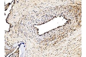 IHC analysis of Glycogen synthase 1/GYS1 using anti-Glycogen synthase 1/GYS1 antibody (ABIN7602155). (Glycogen Synthase 1 抗体  (AA 60-640))