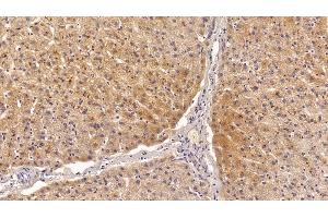 Immunohistochemistry (IHC) image for anti-Ferritin, Heavy Polypeptide 1 (FTH1) (AA 1-183) antibody (ABIN7435313)