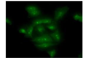 ICC/IF analysis of COMMD7 in A549 cells line, stained with monoclonal anti-human COMMD7 antibody (1:100) with goat anti-mouse IgG-Alexa fluor 488 conjugate (Green). (COMMD7 抗体  (AA 1-200))