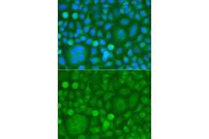 Immunofluorescence analysis of HeLa cells using EPM2A antibody (ABIN5974214). (EPM2A 抗体)