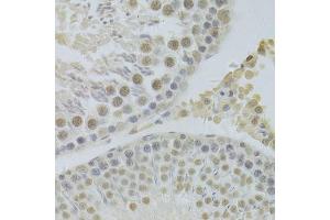 Immunohistochemistry of paraffin-embedded rat testis using HDGF Antibody. (HDGF 抗体  (AA 1-240))