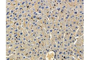 RFLNB Antibody at 1/100 staining mouse liver tissue by IHC-P. (Refilin-B (RFLNB) 抗体)