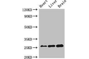 Western Blot Positive WB detected in: Mouse heart tissue, Mouse liver tissue, Mouse brain tissue All lanes: RND2 antibody at 2 μg/mL Secondary Goat polyclonal to rabbit IgG at 1/50000 dilution Predicted band size: 26 kDa Observed band size: 26 kDa (RND2 抗体  (AA 104-163))