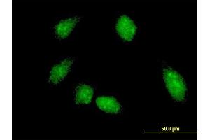 Immunofluorescence of monoclonal antibody to FLI1 on HeLa cell. (FLI1 抗体  (AA 1-452))
