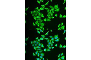 Immunofluorescence (IF) image for anti-Phosphoglucomutase 1 (PGM1) antibody (ABIN1980319) (Phosphoglucomutase 1 抗体)