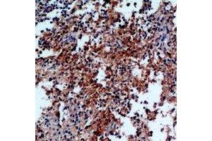 Immunohistochemical analysis of IL-31 staining in human spleen formalin fixed paraffin embedded tissue section. (IL-31 抗体)