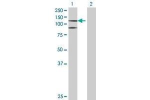 Lane 1: EPAS1 transfected lysate ( 95. (EPAS1 293T Cell Transient Overexpression Lysate(Denatured))
