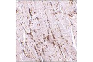 Immunohistochemistry of LIMP2 in human skeletal muscle with this product at 2. (SCARB2 抗体  (Center))