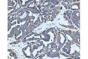 IHC analysis of Neurofibromin/NF1 using anti-Neurofibromin/NF1 antibody (ABIN7600197). (Neurofibromin 1 抗体  (AA 160-270))
