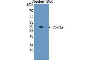 Western blot analysis of the recombinant protein. (IFNE 抗体  (AA 30-208))