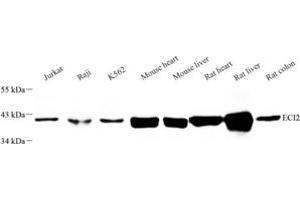 Western blot analysis of ECI2 (ABIN7073837) at dilution of 1: 500 (PECI/ECI2 抗体)