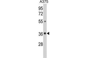 Western blot analysis of GALE Antibody (Center) in A375 cell line lysates (35 µg/lane). (GALE 抗体  (Middle Region))