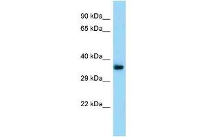 Western Blotting (WB) image for anti-Transmembrane Protein 164 (TMEM164) (N-Term) antibody (ABIN2788478) (TMEM164 抗体  (N-Term))