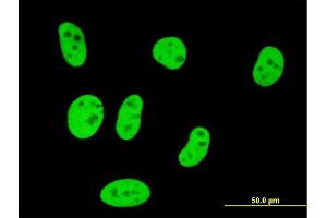 Immunofluorescence of monoclonal antibody to SMAD3 on HeLa cell. (SMAD3 抗体  (AA 147-270))
