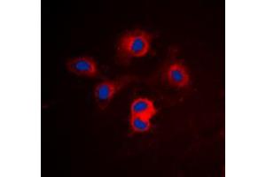 Immunofluorescent analysis of BCLX staining in Jurkat cells.