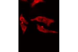 ABIN6275022 staining  Hela cells by IF/ICC. (RCL 抗体  (N-Term))