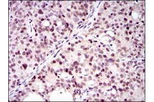 Immunohistochemistry (IHC) image for anti-Proliferating Cell Nuclear Antigen (PCNA) (AA 53-196) antibody (ABIN1724759)