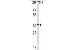 Western blot analysis in ZR-75-1 cell line lysates (35ug/lane). (FUT7 抗体  (N-Term))