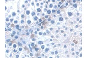 Detection of KIBRA in Mouse Testis Tissue using Polyclonal Antibody to Kidney And Brain Protein (KIBRA)