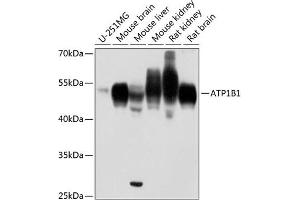 Western blot analysis of extracts of various cell lines, using B1 antibody (ABIN6127387, ABIN6137304, ABIN6137307 and ABIN6216023) at 1:1000 dilution. (ATP1B1 抗体  (AA 65-240))
