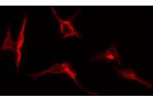 ABIN6277063 staining  HepG2 cells by IF/ICC. (FGFR1 抗体  (C-Term))