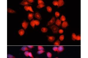 Immunofluorescence analysis of HeLa cells using SLC25A5 Polyclonal Antibody at dilution of 1:100 (40x lens). (SLC25A5 抗体)