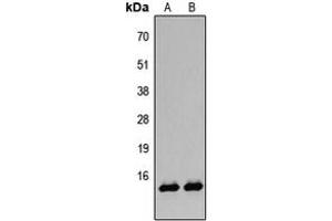 Western blot analysis of Histone H2B (AcK12) expression in A431 TSA-treated (A), HeLa TSA-treated (B) whole cell lysates. (Histone H2B 抗体  (acLys12, N-Term))