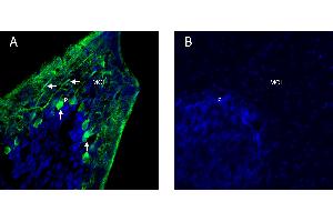 anti-Oxoglutarate (Alpha-Ketoglutarate) Receptor 1 (OXGR1) (AA 185-199), (Extracellular), (Loop 2) antibody