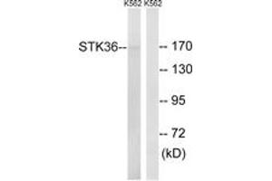 Western blot analysis of extracts from K562 cells, using STK36 Antibody.