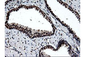 Image no. 1 for anti-EPM2A (Laforin) Interacting Protein 1 (EPM2AIP1) antibody (ABIN1498046) (EPM2AIP1 抗体)