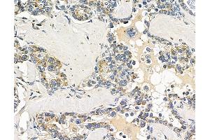 anti-Lipin 2 (LPIN2) antibody