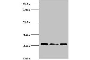 Western blot All lanes: Chloride intracellular channel protein 1 antibody at 4 μg/mL Lane 1: Hela whole cell lysate Lane 2: Jurkat whole cell lysate Lane 3: MCF-7 whole cell lysate Secondary Goat polyclonal to rabbit IgG at 1/10000 dilution Predicted band size: 27 kDa Observed band size: 27 kDa (CLIC1 抗体  (AA 42-241))