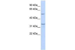 WB Suggested Anti-ZNF765 Antibody Titration:  0. (ZNF765 抗体  (Middle Region))