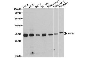 Western blot analysis of extracts of various cell lines, using SNAI1 antibody. (SNAIL 抗体  (AA 1-264))