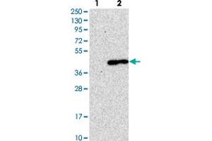 Western blot analysis of Lane 1: Negative control (vector only transfected HEK293T lysate). (LMAN2 抗体)
