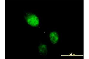 Immunofluorescence of purified MaxPab antibody to RAD23B on HeLa cell. (RAD23B 抗体  (AA 1-409))
