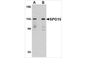 Western blot analysis of SPG15 in rat heart tissue lysate with SPG15 antibody at (A) 0. (ZFYVE26 抗体  (C-Term))