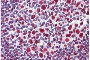 Human Tonsil: Formalin-Fixed, Paraffin-Embedded (FFPE) (GRB2 抗体  (AA 156-217))