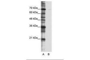 Image no. 1 for anti-Cleavage Stimulation Factor, 3' Pre-RNA, Subunit 2, 64kDa, tau Variant (CSTF2T) (AA 521-570) antibody (ABIN6736229) (CSTF2T 抗体  (AA 521-570))