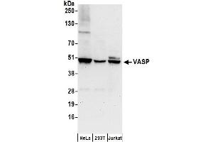 anti-Vasodilator-Stimulated phosphoprotein (VASP) (AA 330-380) antibody